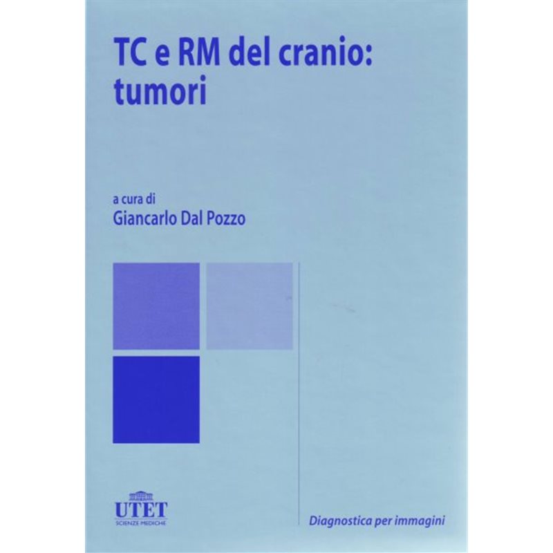 TC e RM del cranio: tumori